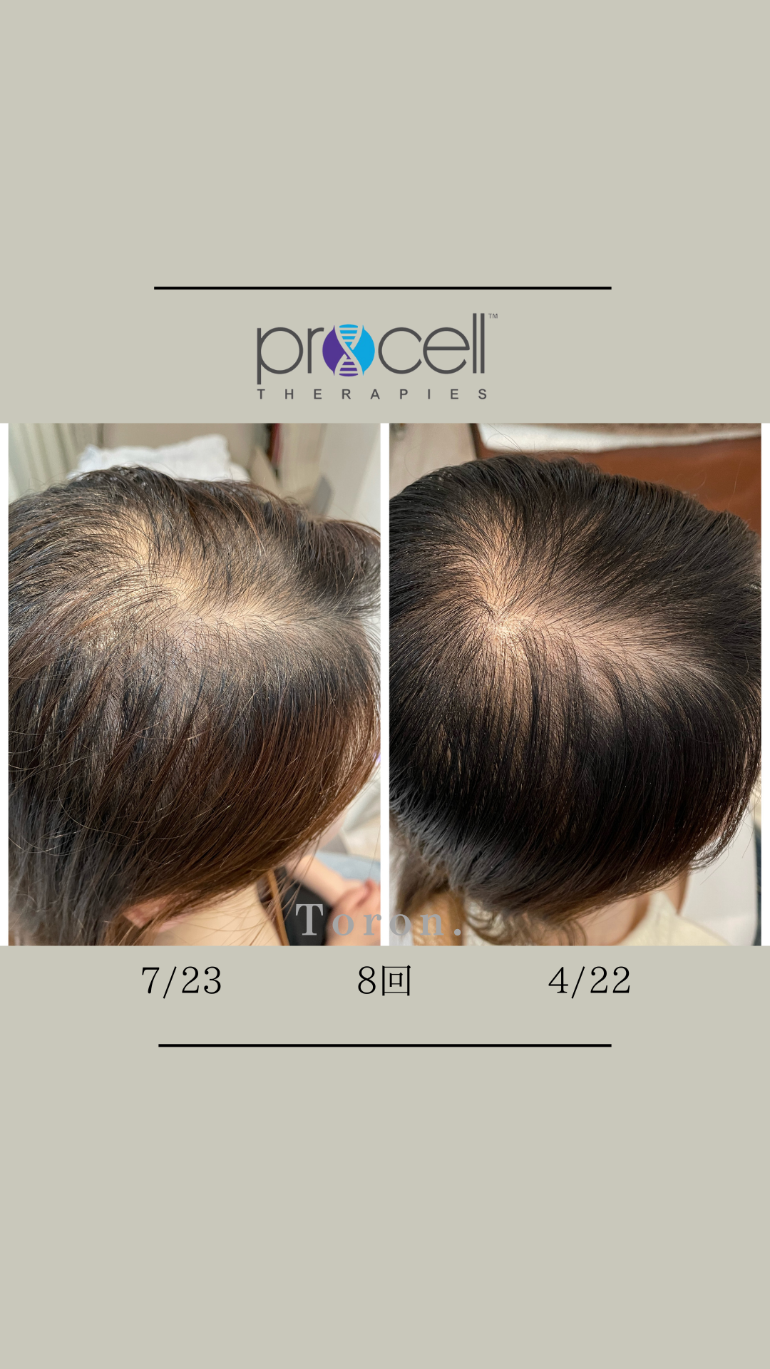 procell theraples プロセルセラピーズ | Toron.